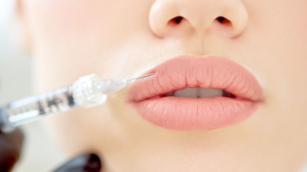 Aufgespritzte Lippen sind gefragter denn je - vor allem bei jungen Frauen. Foto: Imago/Depositphotos